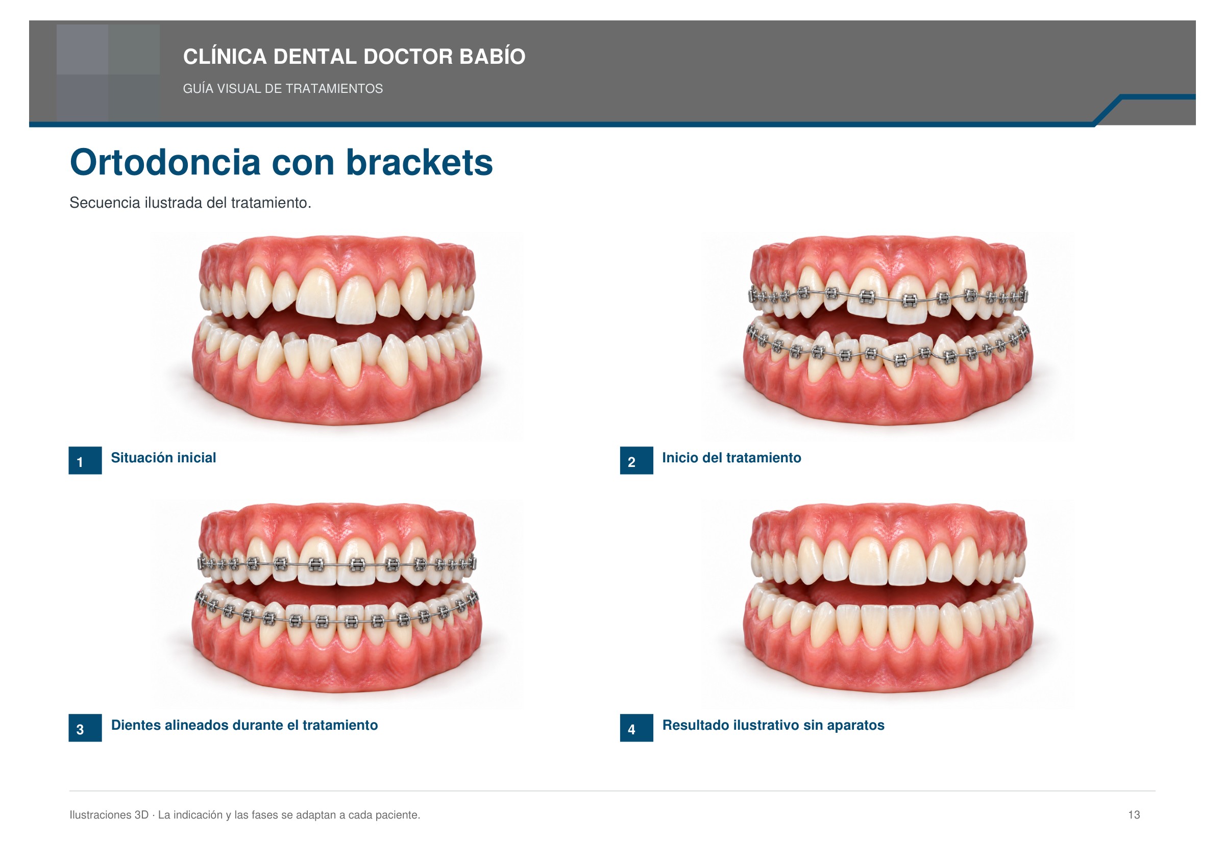 Ortodoncia con brackets: secuencia ilustrada, página 13 del cuaderno