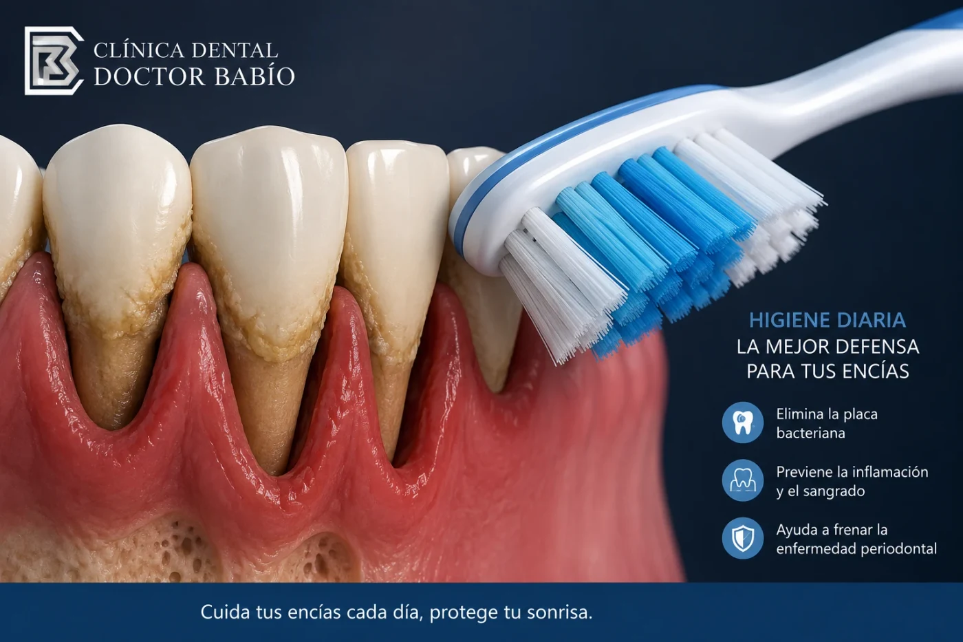 Higiene bucodental en paciente con periodontitis y cepillo dental