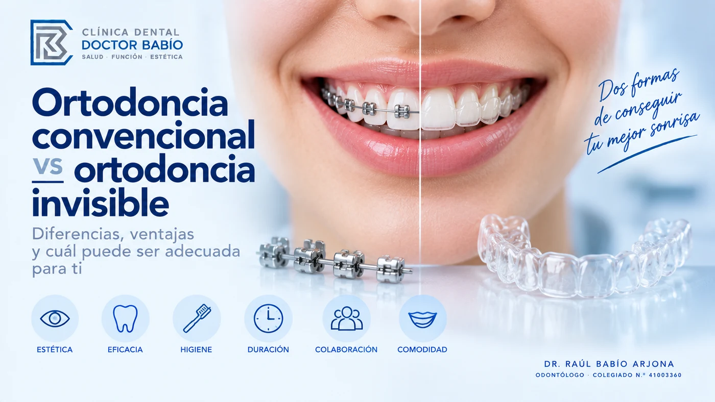 Comparación entre ortodoncia convencional con brackets y ortodoncia invisible con alineadores transparentes
